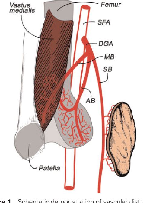 Figure From A Composite Osteomusculocutaneous Free Flap From The