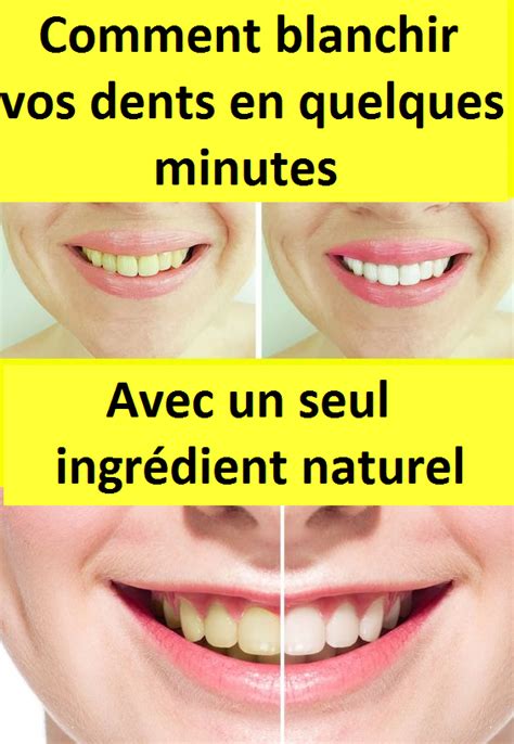 Comment blanchir vos dents en quelques minutes avec un seul ingrédient