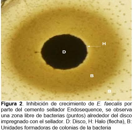 Inhibición in vitro del crecimiento de enterococcus faecalis empleando