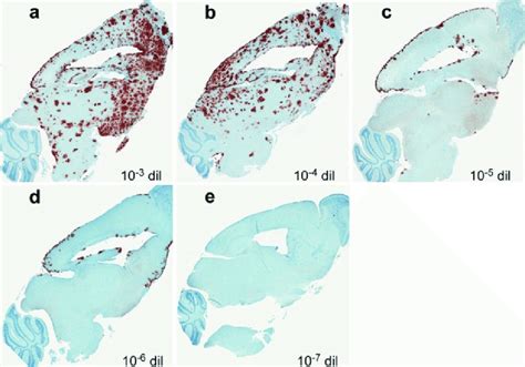 Immunohistochemistry For PrPres In Brains Of Tg44 Mice Following