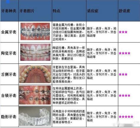 常见问题解答重庆牙齿矫正哪家好？哪种牙套比较好，多少钱？ 知乎