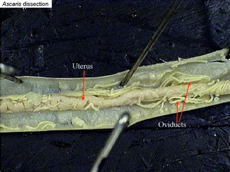 Ascaris Dissection Male And Female