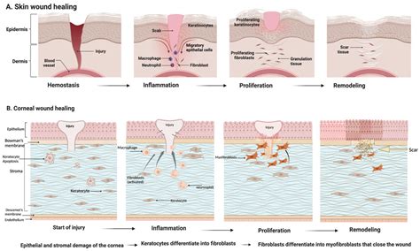 Weeping Wounds: A Comprehensive Guide To Pain Management