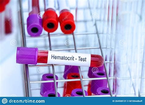 Hematocrit Test To Look For Abnormalities From Blood Stock Image