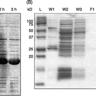 A SDS PAGE Analysis Of E Coli Whole Cell Lysates Before And After