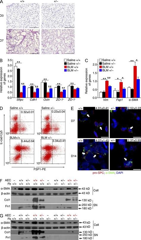 Fstl Deficiency Protects Epithelial Cells From Injury A Lung