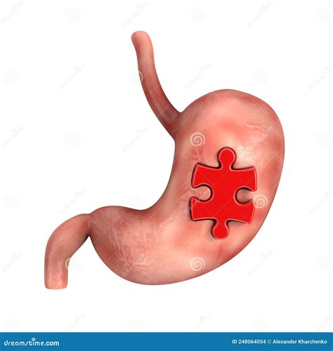 Stomach Surgery Concept Human Stomach Anatomy Internal Organ With Red