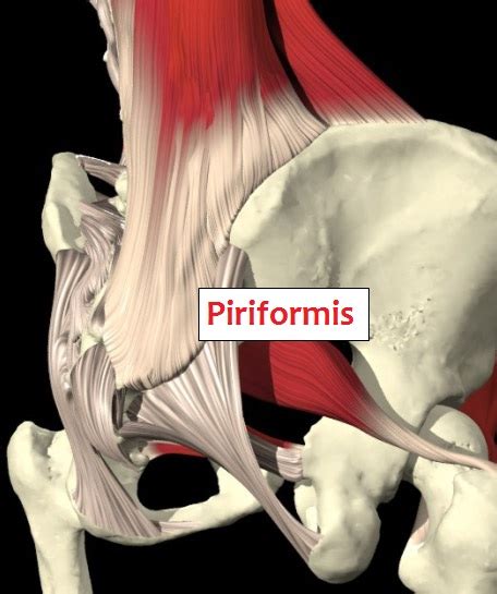 Piriformis Tester So What Do I Do You Ask Sunstone Registered