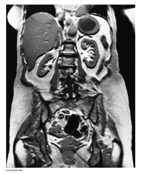 Diagram of MRI of the abdomen | Quizlet