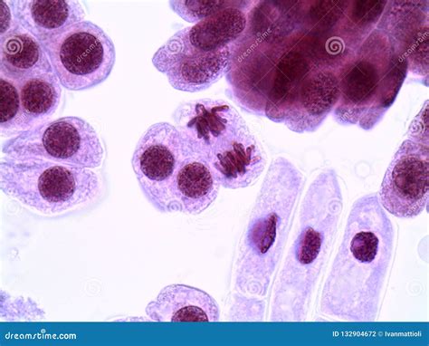 Anaphase Microscope