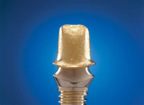 Galvanotechnik – Dentaltechnik Bachmann