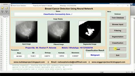 Breast Cancer Detection Using Neural Network Matlab Project Source Code