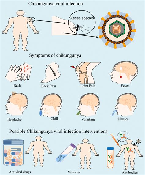 Chikungunya Symptoms And Diagnosis