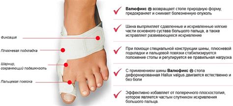 Фиксатор для коррекции большого пальца ноги - Здоровые и красивые ноги