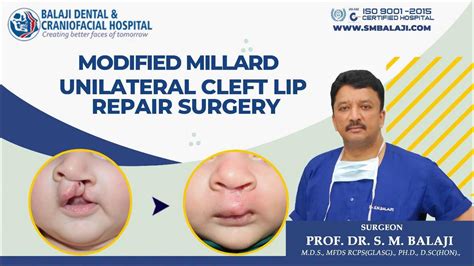 Modified Millard Unilateral Cleft Lip Repair Surgery Youtube