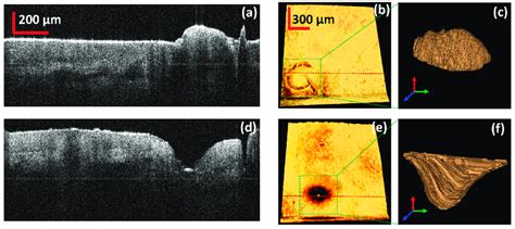 Comparative analysis of the high lateral resolution OCT images before... | Download Scientific ...