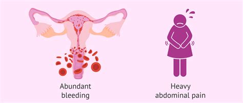 Due Date For 5 Day Embryo Transfer Aynsleyroddy