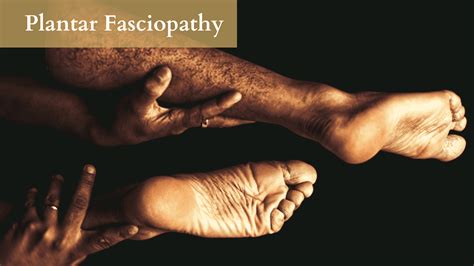 Plantar Fasciopathy Physiochoice Blog