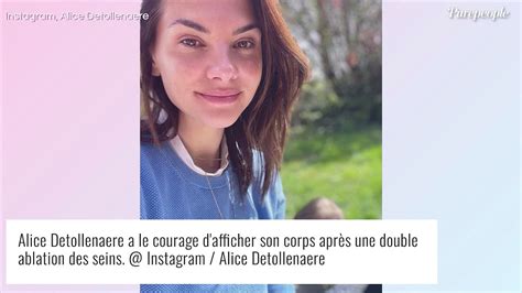 Après son ablation du sein Alice Detollenaere s affiche sublime et