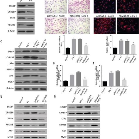 Overexpression Of Rbm Rescues Angiotensin Ii Induced Myocardial