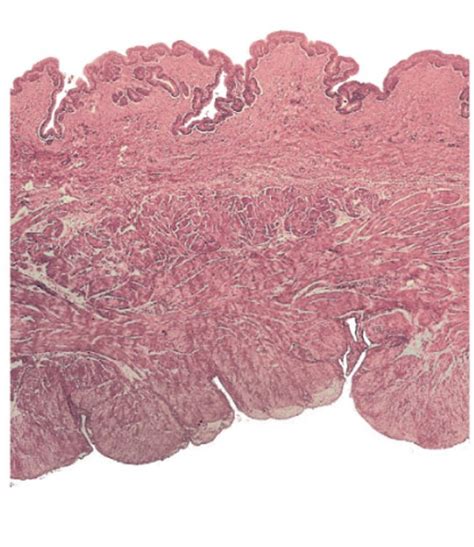 Bladder Histology Diagram | Quizlet