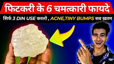 Use Acne Tiny Bumps Fitkari Benefits Benefits