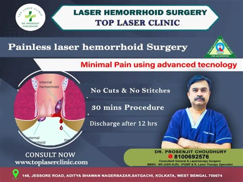 5 Pros And 5 Cons Of Laser Hemorrhoid Surgery