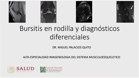 Bursitis En Rodilla Y Diagn Sticos Diferenciales Dr Palacios