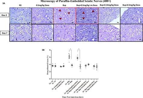 Microscopic Changes Of Sciatic Nerves After Sciatic Nerve Block 3A