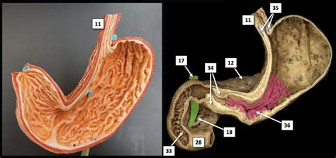 Stomach labeling Diagram | Quizlet