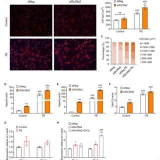 Slc39a2 Deficiency Activates Innate Immune Signaling During