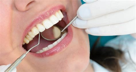 What Is Gingivitis Causes Symptoms And Treatment The Orthodontists