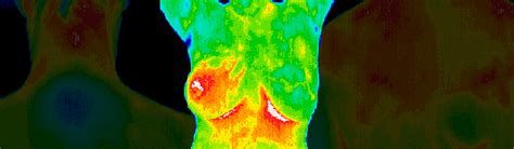 breast-thermography-02