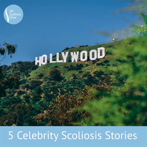 5 Celebrity Scoliosis Stories - Scoliosis Clinic UK - Treating ...