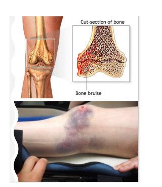 Modalities Flashcards | Quizlet 