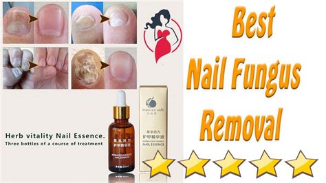 Best Nail Fungus Removal Reviews 2018 YouTube