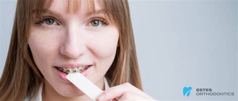 Dos And Donts Of Gum Chewing During Orthodontics Treatment