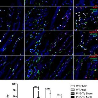 The Levels Of Hdac And Histone Acetylation In Cardiac Fibroblasts In