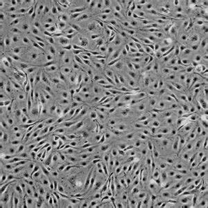 Human Pulmonary Microvascular Endothelial Cells Innoprot Cell Systems