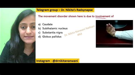 Movement Disorders And Site Mnemonic Of The Day Dr Nikita Nanwani Nikmonics Neetpg Fmge