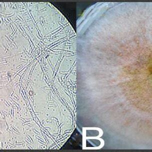 Fusarium oxysporum (A) under microscope (B) morphology on PDA medium ...