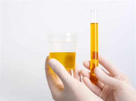 Alcohol and Urine - Breathalysers New Zealand