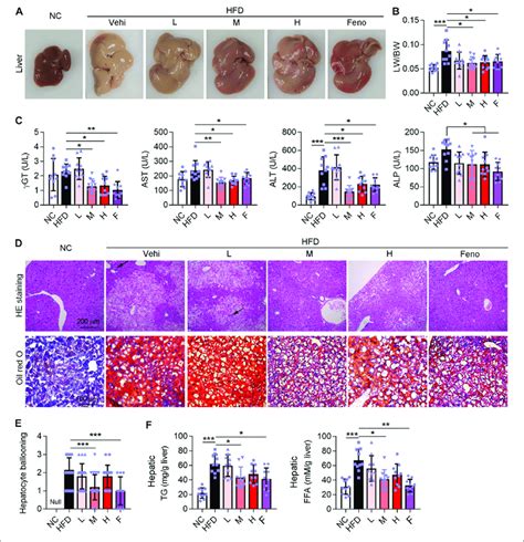 Ganweikang Tablet Alleviates Liver Lesions In Hfd Induced Nafl Mice