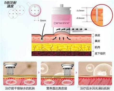 沙漠肌的自救攻略 知乎