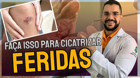 Voc N O Cicatriza A Ferida Se N O Seguir Esses Passos Principios Da