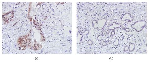 Human Cholangiocarcinoma Cell Lines Atcc Bioz