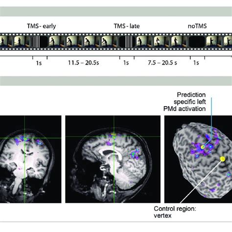 Graphs Show The Mean Rts For Tms Early And Tms Late In The Left Pmd And