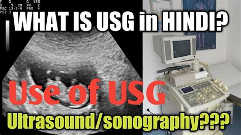 What Is Usg Sonography Ultrasound In Hindi By Medical Hub Ultrasound