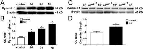 Dynamin 1 Protein Expression Level In An Acute Seizure Model At