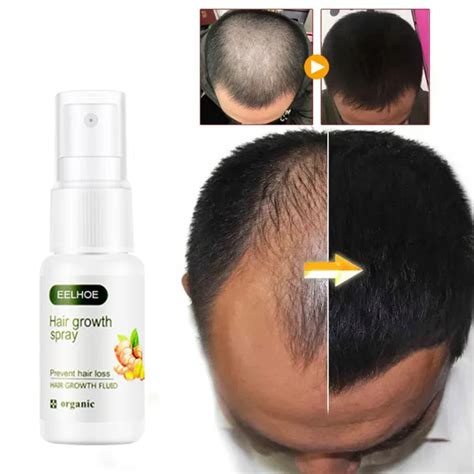 Semprotan Penumbuh Rambut Hair Growth Serum Hair Growth Spray 20ml